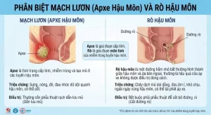 Lưu nháp tự động