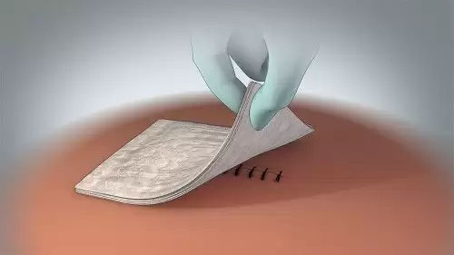 Chăm Sóc Sau Mổ Rò Hậu Môn