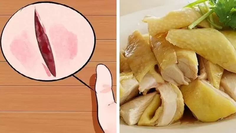 Bị Rò Hậu Môn Có Ăn Thịt Gà Được Không
