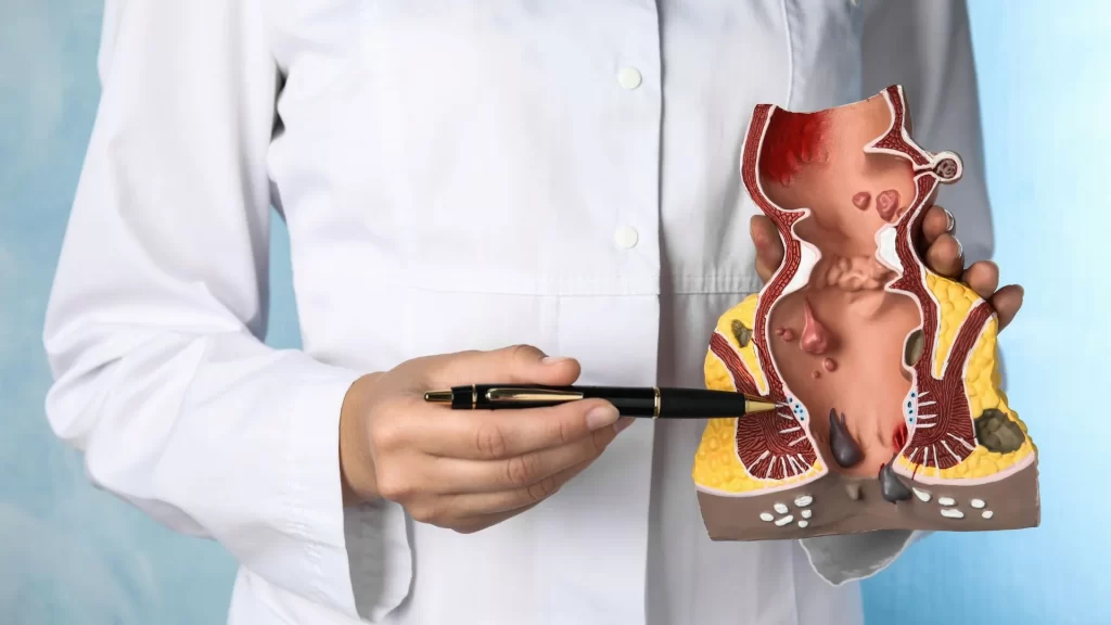 Dấu Hiệu Rò Hậu Môn
