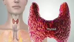 Điều Trị Bướu Nhân Tuyến Giáp