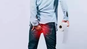 Triệu Chứng Rò Hậu Môn Tái Phát: Dấu Hiệu Nhận Biết Sớm Và Cách Điều Trị Hiệu Quả