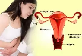 UNG THƯ BUỒNG TRỨNG CHẨN ĐOÁN VÀ ĐIỀU TRỊ