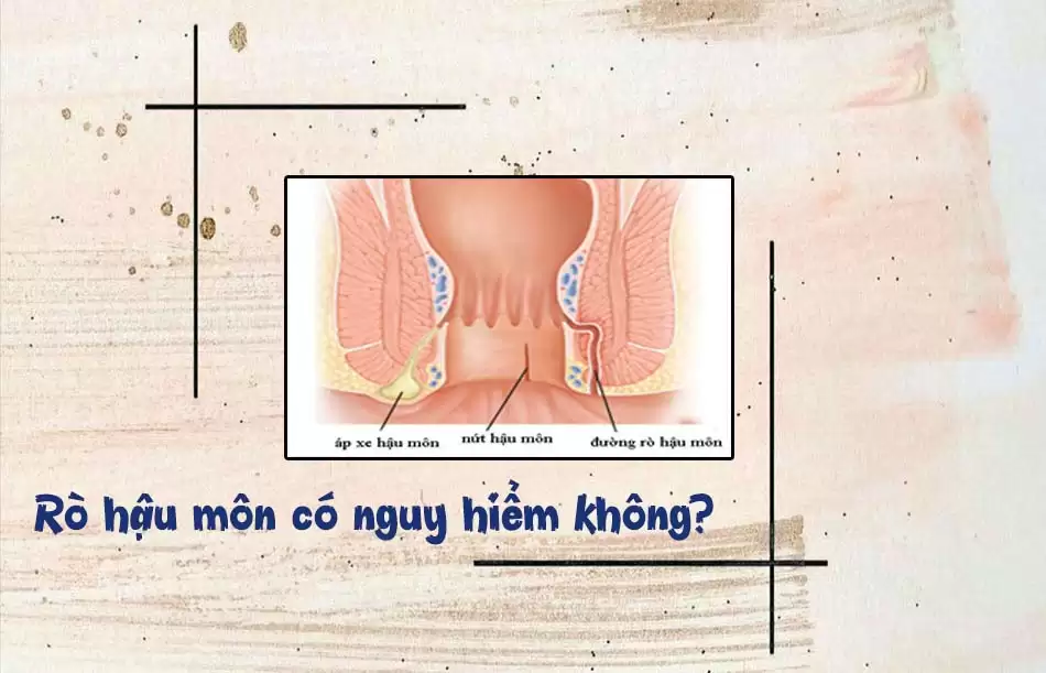 Chăm Sóc Sau Mổ Rò Hậu Môn