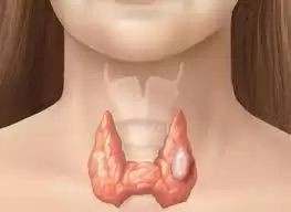 Bệnh Lý Bướu Nhân Tuyến Giáp