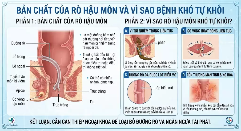 Rò hậu môn có ảnh hưởng sức khỏe lâu dài không